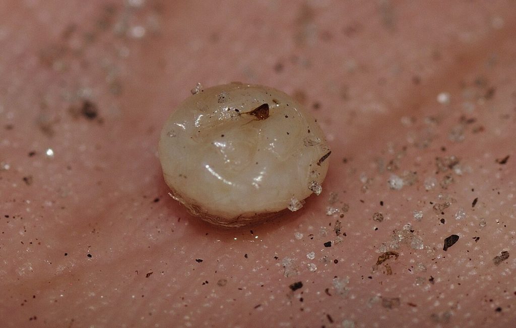 What Do Flea Eggs Look Like?